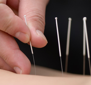 Cancer Acupuncture Holistic Care Dr. He - He's treatment