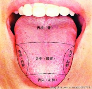 Cancer Acupuncture Holistic Care Dr. He - Traditional Chinese Medicine Tongue diagnosis